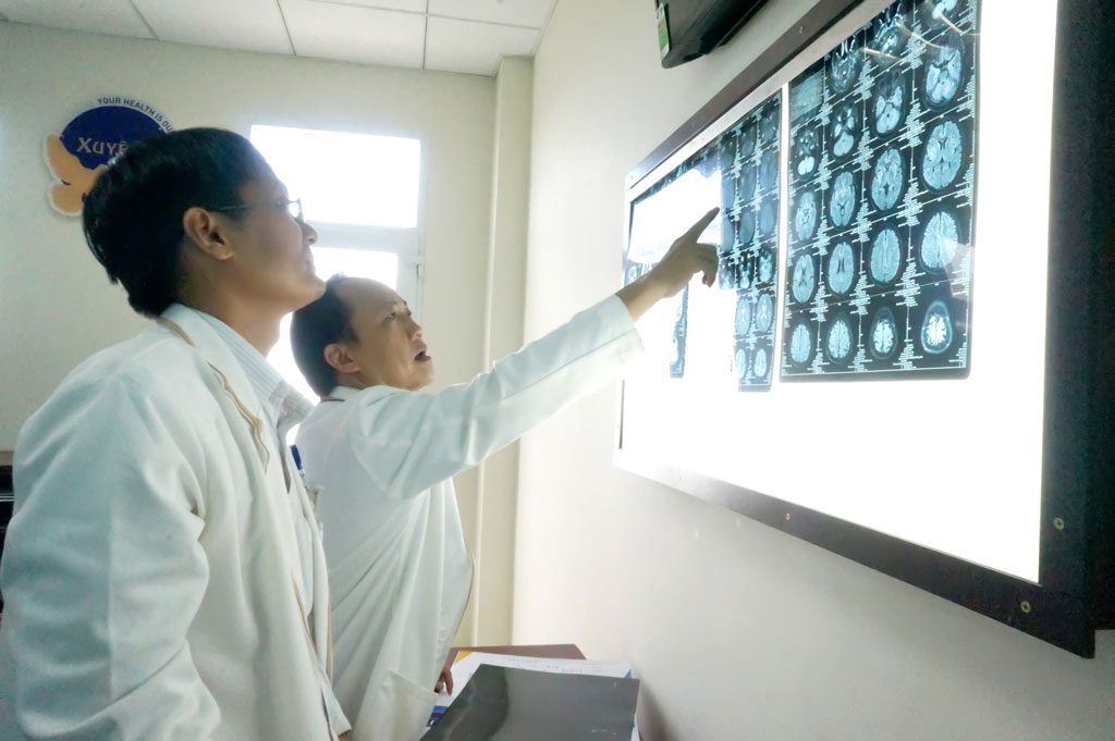 Các bác sĩ Nội Thần Kinh phân tích bệnh lý qua phim chụp cắt lớp vi tính (CT) 160 lát.