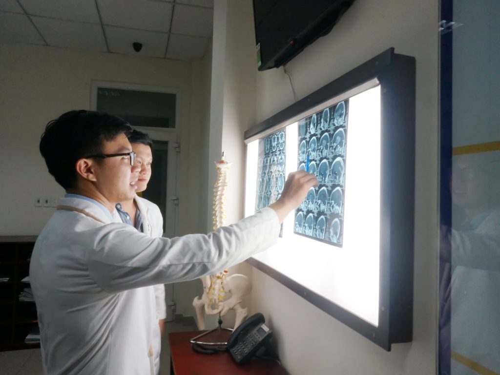 Ảnh các bác sĩ đọc phim chụp CT 160 lát sọ não của bệnh nhân.