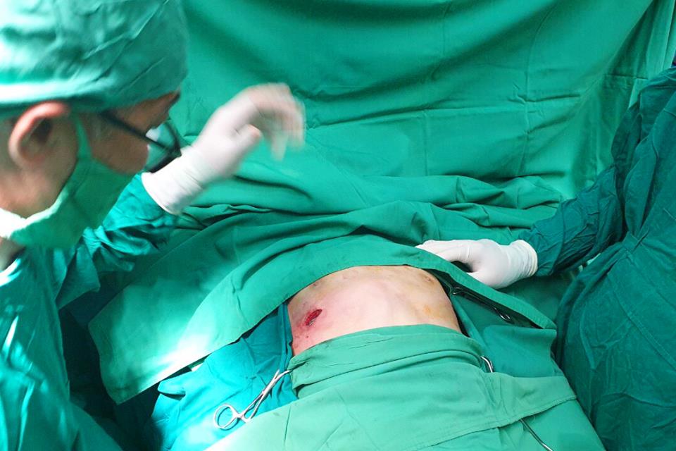 Hình ảnh bác sĩ thực hiện phẫu thuật nâng ngực lõm bẩm sinh cho bệnh nhân