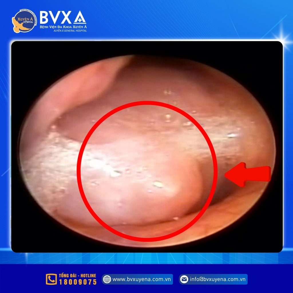Hình ảnh khối u thông qua thiết bị