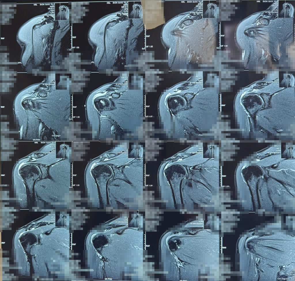 Hình ảnh cận lâm sàng của bệnh nhân