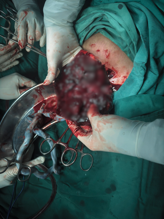 Hình ảnh bánh nhau bong non