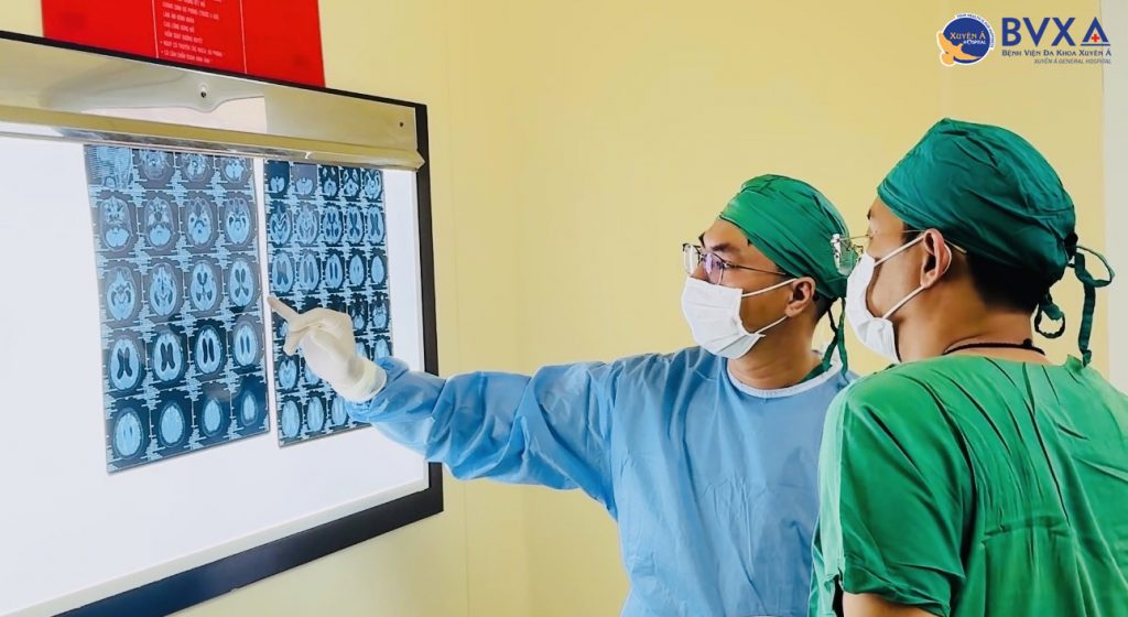 Kết quả MRI của bệnh nhân trong quá trình dẫn lưu não thất ổ bụng