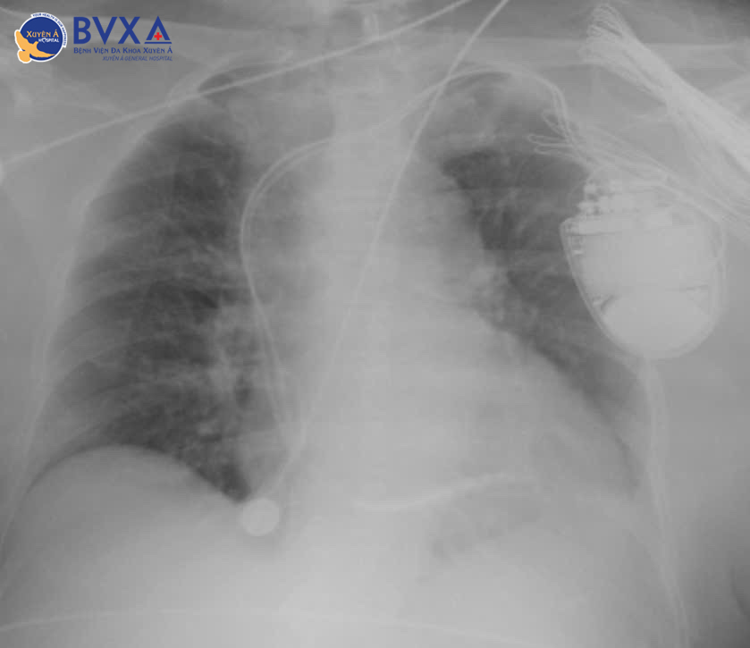 Hình ảnh cận lâm sàng