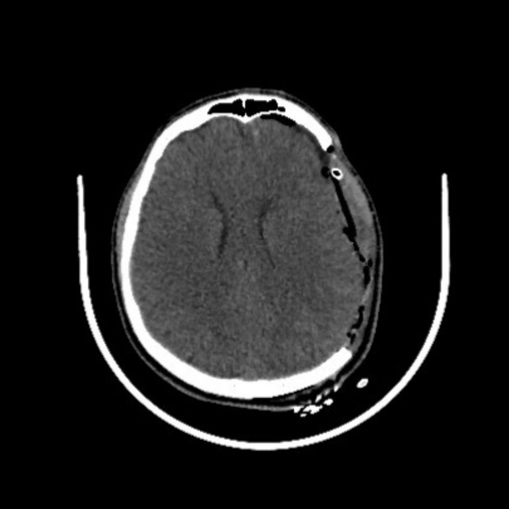 Hình ảnh cận lâm sàng sau phẫu thuật