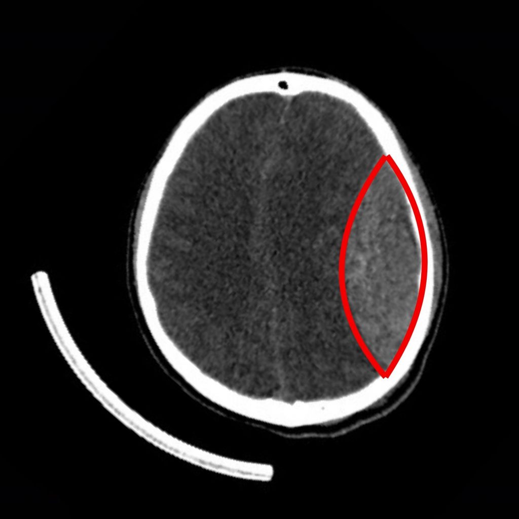Hình ảnh cận lâm sàng trước phẫu thuật