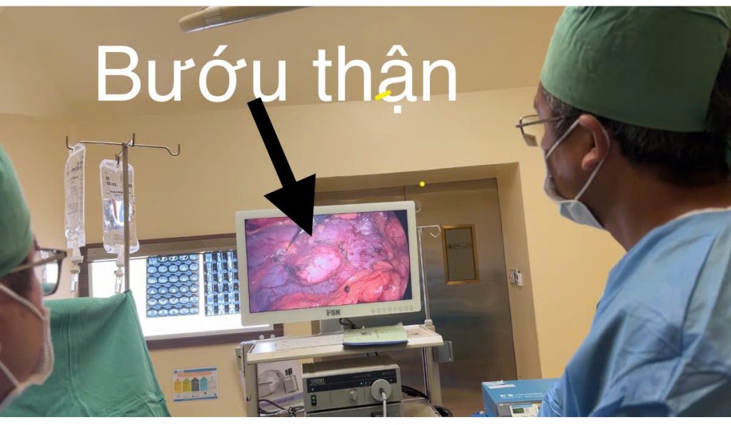 Hình ảnh bướu trên phẫu thuật
