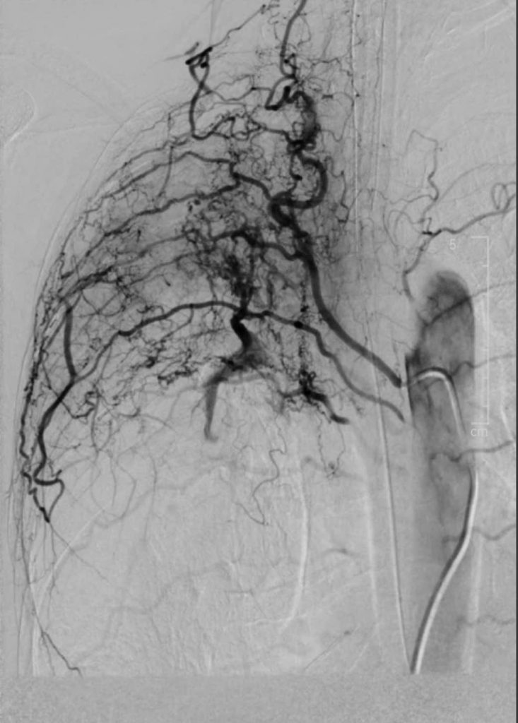 Hình ảnh trước can thiệp