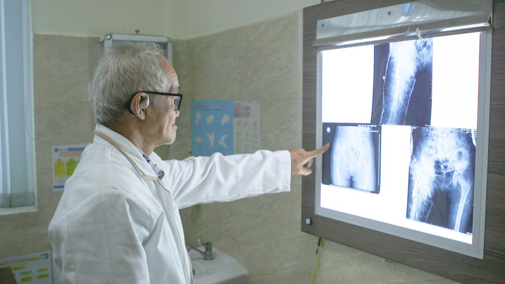 Hình ảnh TTƯT. BS. CKII. Phan Văn Tiếp xem phim X-Quang vùng dị tật tay chân bẩm sinh