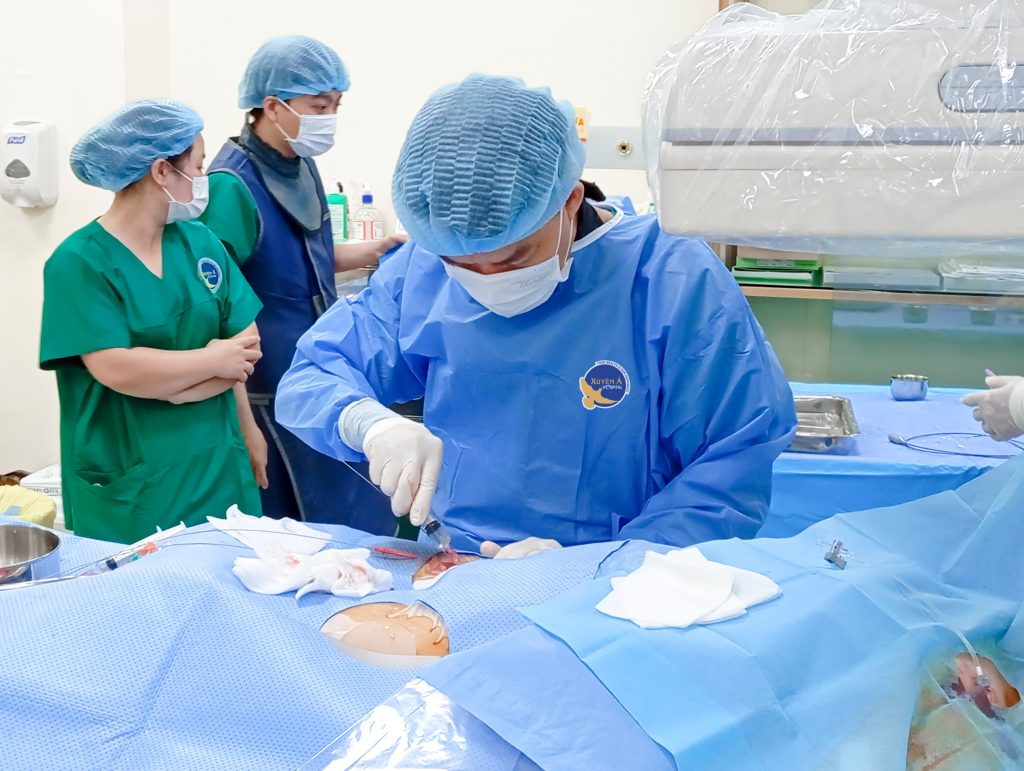 Hình ảnh thực hiện thủ thuật trước khi triệt đốt rung nhĩ