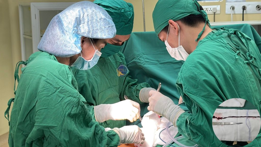 Ảnh ghi nhận trong ca phẫu thuật cho bệnh nhân tắc động mạch đùi