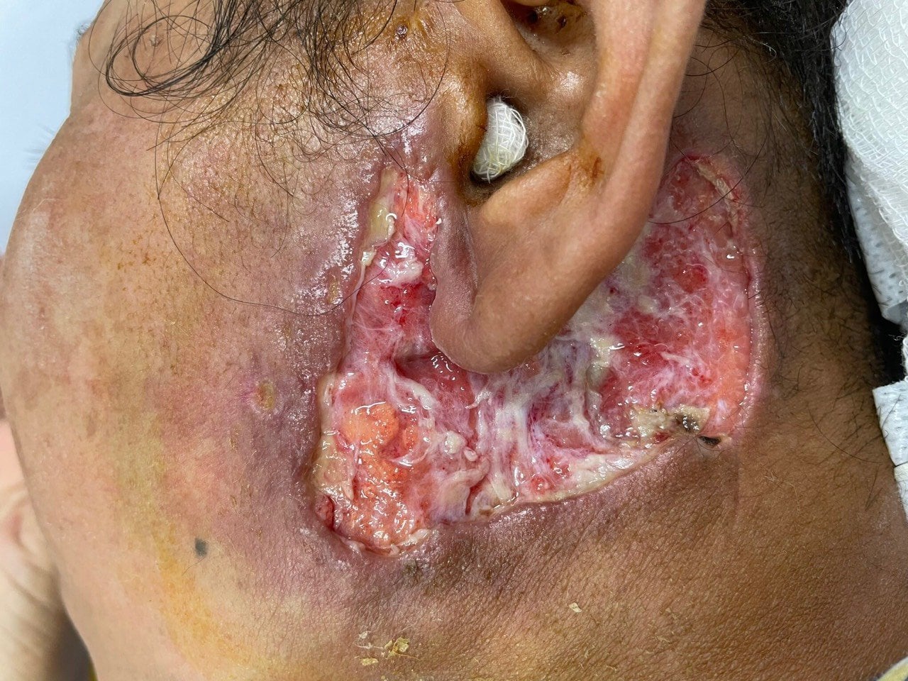 Ảnh tiêu biểu