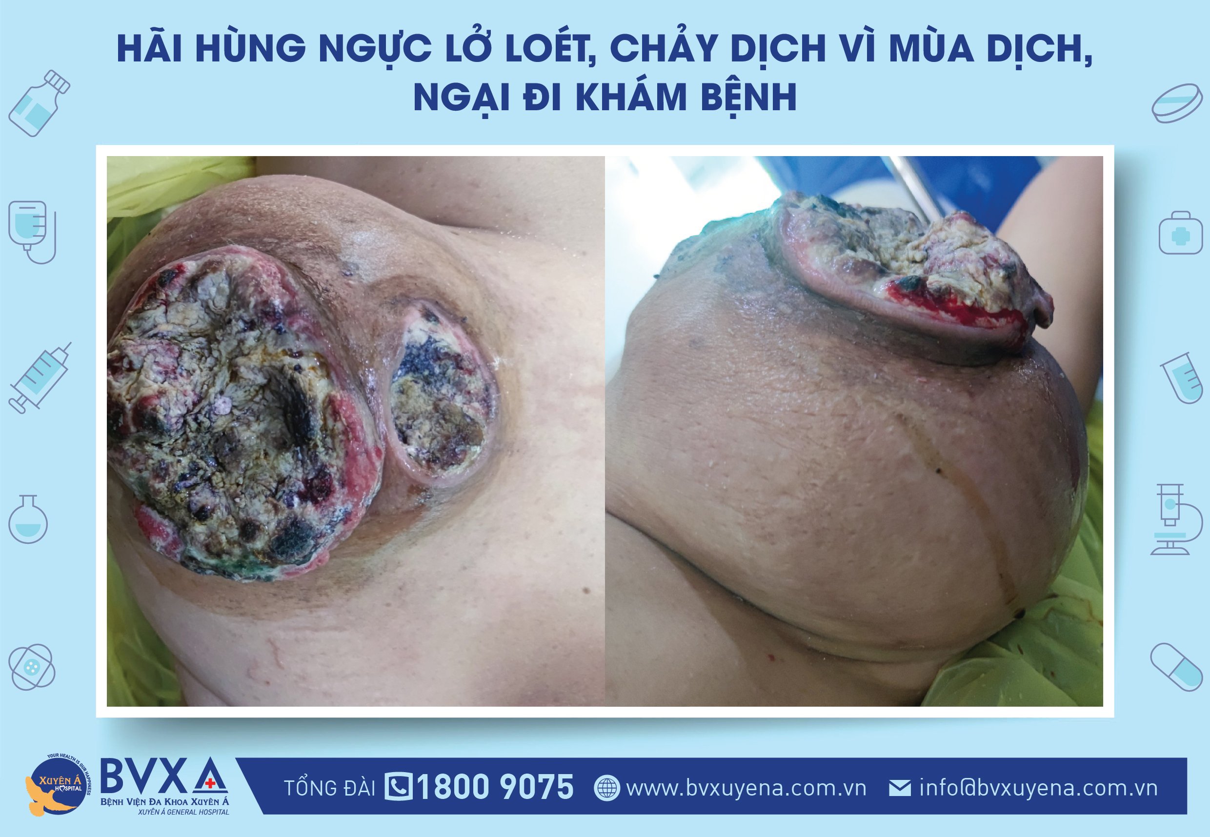 Ảnh tiêu biểu