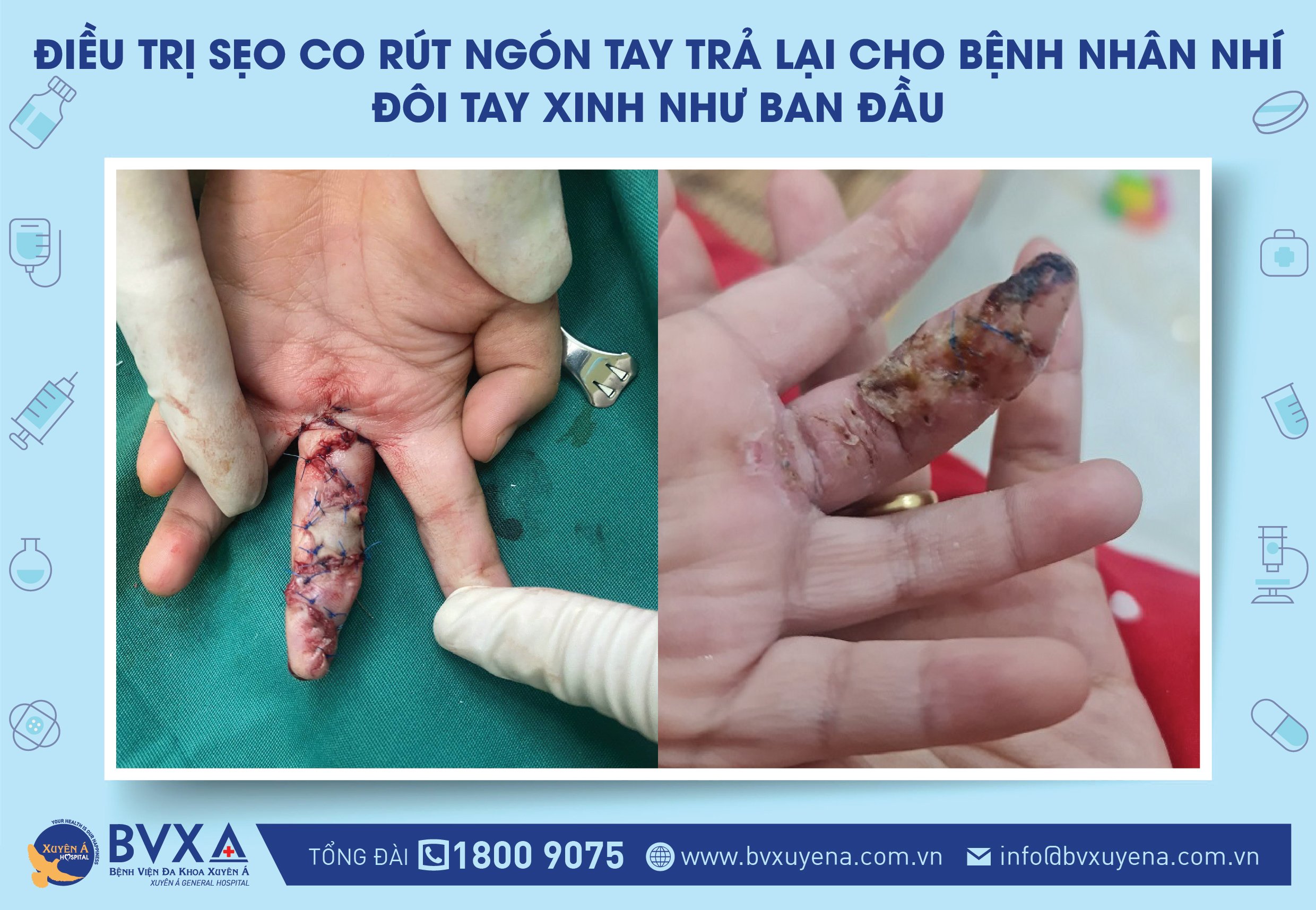 Ảnh tiêu biểu