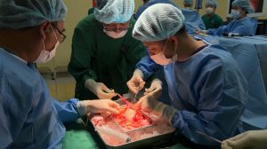 Thận sau khi được lấy ra và bảo quản trước khi ghép sau khi được lấy ra và bóc tách trước khi ghép