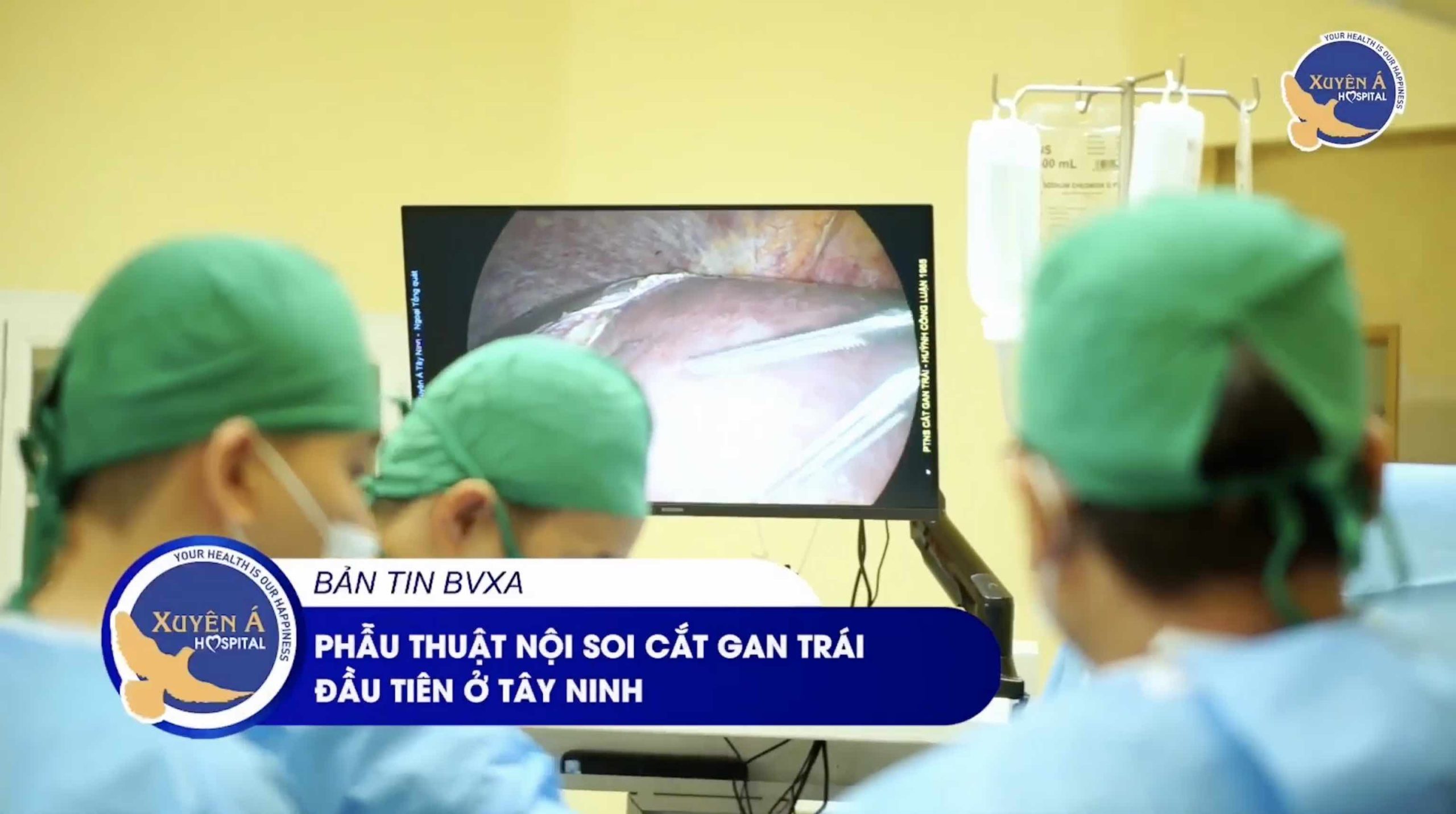 BVĐK Xuyên Á Tây Ninh - phẫu thuật nội soi cắt gan trái đầu tiên ở tây ninh