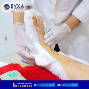 Hình ảnh bác sĩ thăm khám tình trong bệnh nhân bị đứt động mạch chày trước