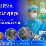 THOÁT VỊ BẸN, ĐỪNG ĐỢI ĐẾN KHI BIẾN CHỨNG MỚI LO ĐIỀU TRỊ