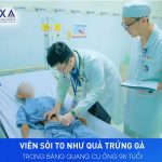 SỎI BÀNG QUANG TO NHƯ QUẢ TRỨNG CỦA CỤ ÔNG 98 TUỔI