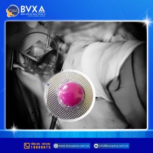 Hình ảnh viên thuốc sau khi lấy ra