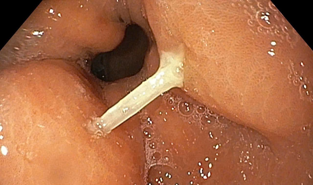 Ảnh tiêu biểu