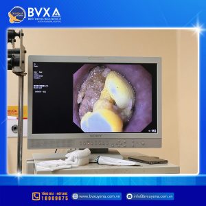 Quá trình lấy dị vật đường tiêu hoá
