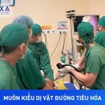MUÔN KIỂU DỊ VẬT ĐƯỜNG TIÊU HÓA