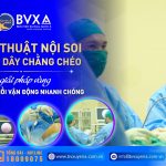 TÁI TẠO DÂY CHẰNG CHÉO BẰNG PHƯƠNG PHÁP PHẪU THUẬT NỘI SOI – GIẢI PHÁP VÀNG GIÚP PHỤC HỒI VẬN ĐỘNG NHANH CHÓNG