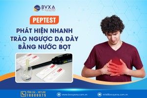 Kỹ thuật PEPTEST