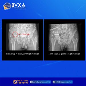Hình ảnh CT của bệnh nhân