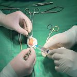 PHẪU THUẬT VI PHẪU – KHÔNG CHỈ NỐI CHI MÀ LÀ NỐI LẠI CẢ TƯƠNG LAI