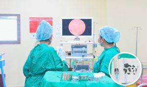 Hình ảnh quá trình phẫu thuật viêm xoang nấm