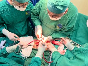 Hình ảnh ekip phẫu thuật loại bỏ bướu bàng quang