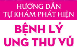 Hướng dẫn tự khám phát hiện bệnh lý ung thư vú