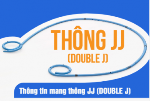 Thông tin mang thông JJ (Double J)