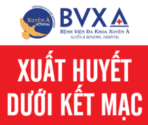 Xuất huyết dưới kết mạc