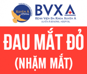 Đau mắt đỏ (Nhặm mắt)
