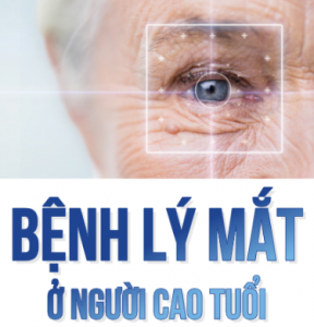 Bệnh lý mắt ở người cao tuổi 2