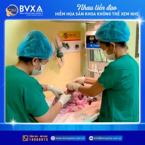 Hình ảnh y bác sĩ chăm sóc bé gái sơ sinh nặng 3000gram sau khi sinh