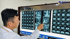 Hình ảnh bác sĩ xem kết quả cận lâm sàng của bệnh nhân bị sỏi san hô