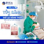 ĐIỀU TRỊ TỦY RĂNG – GIỮ LẠI RĂNG THẬT, BẢO VỆ NỤ CƯỜI CỦA BẠN