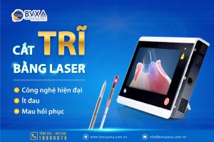 Cắt trĩ bằng laser LHP