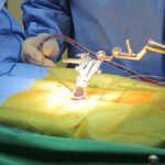 LẤY LẠI NHỊP SỐNG THƯỜNG NGÀY SAU NHIỀU THÁNG KHỔ SỞ VÌ CƠN ĐAU THOÁT VỊ ĐĨA ĐỆM CỘT SỐNG LƯNG