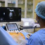 KẾT HỢP KỸ THUẬT TACE VÀ RFA TRONG MỘT LẦN CAN THIỆP – “HAI MŨI GIÁP CÔNG” ĐIỀU TRỊ U GAN ÍT XÂM LẤN