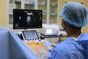 ekip thực hiện kỹ thuật nút mạch TACE kết hợp đốt u bằng sóng cao tần (RFA)