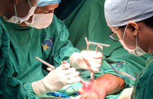 EKIP VI PHẪU NỐI CÁC GÂN CƠ MẠCH MÁU CẲNG TAY ĐỨT LÌA