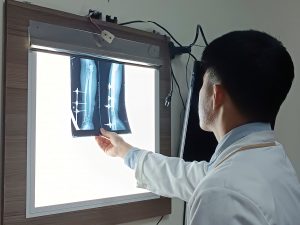 Hình ảnh phim X-Quang sau mổ