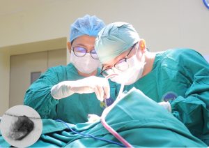 Hình ảnh ekip phẫu thuật