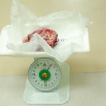 CẮT BỎ KHỐI U VÚ TO NHƯ TRÁI DƯA HẤU CHO BỆNH NHÂN CAMPUCHIA