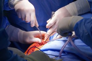 Ekip tiếp cận vị trí thay khớp vai đảo nghịch